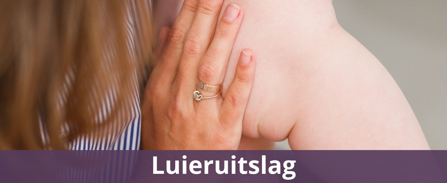 Luieruitslag