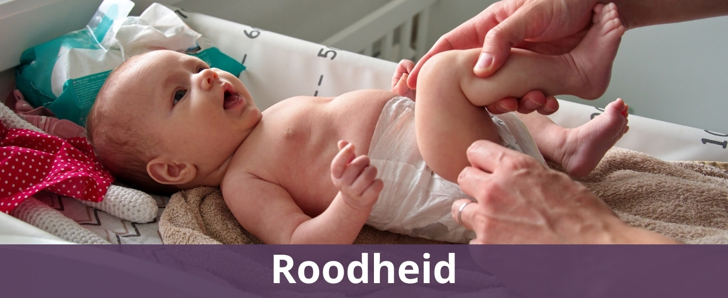 Roodheid