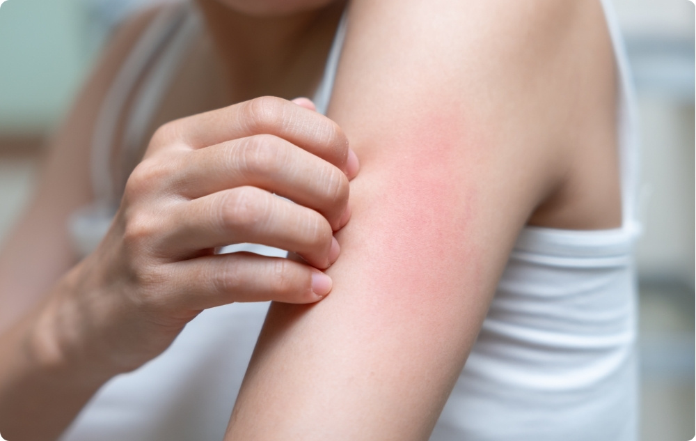 Als olie bij littekens en na irritaties