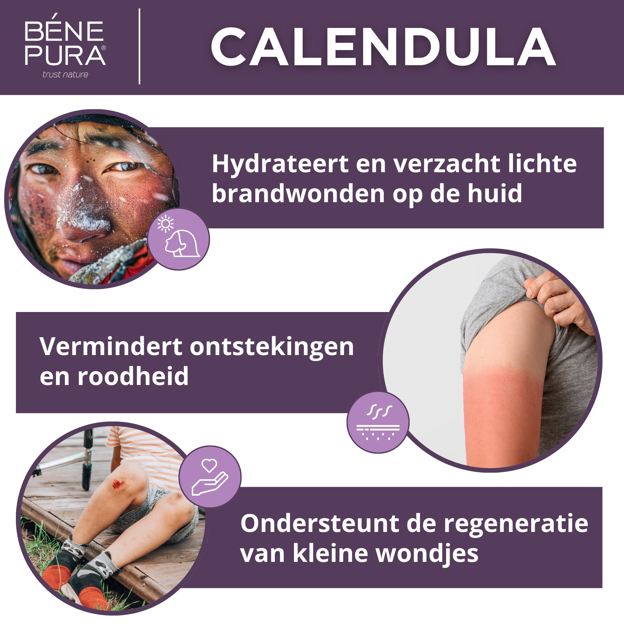 Brand- en Wondzalf met Calendula, Aloë Vera en St. Janskruid - 40ml